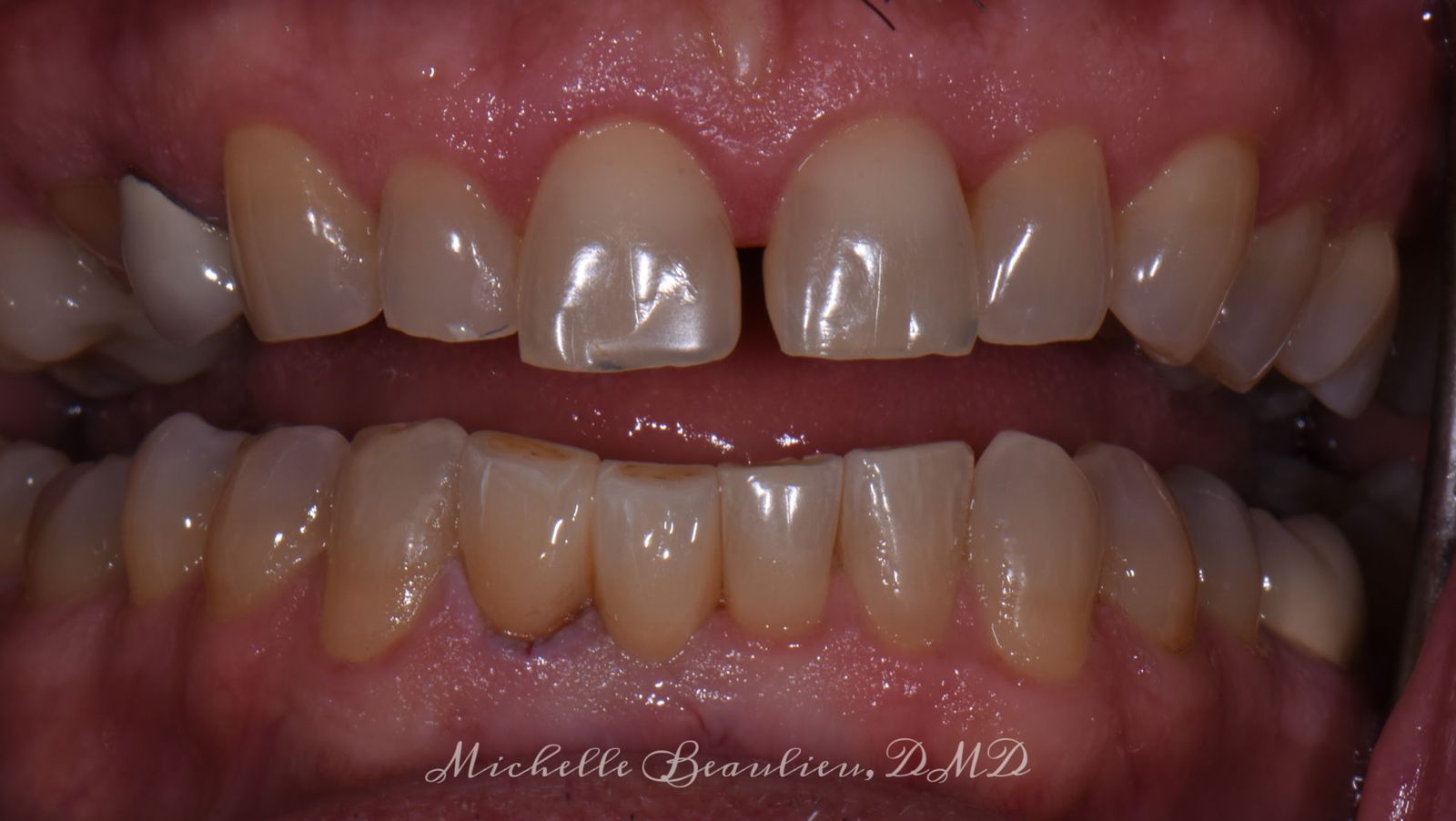 Dr Beaulieu's Work Brightwork Dental Care